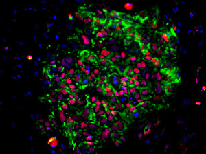 cellules souches, cellules souches plutipotentes induites, SLA 