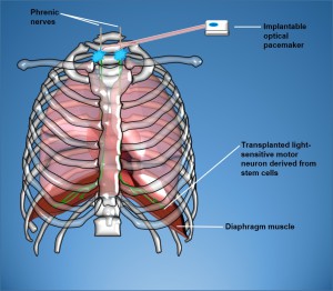 Greensmith  Schéma Diaphragm